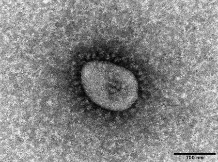新型コロナウイルスのオミクロン株の電子顕微鏡写真（国立感染症研究所提供）