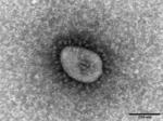 新型コロナウイルス・オミクロン株の電子顕微鏡写真（国立感染症研究所提供）